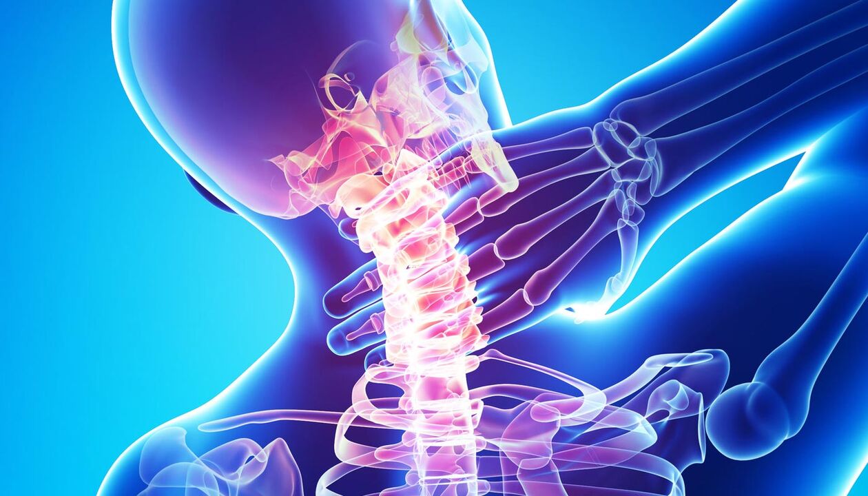 dureri de gât datorate osteocondrozei